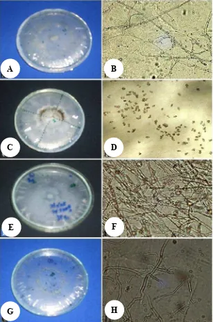 Figure 1. Morphology of some isolates of orchid mycorrhiza isolated from S. plicataA-B: Isolates sp7., C-D: Isolate sp.2., E-F: Tulasnella sp., and G-H: Rhizoctonia sp.
