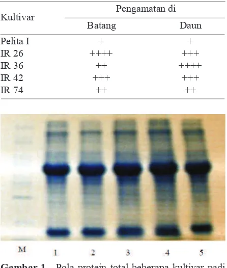 Gambar 1.  Pola protein total beberapa kultivar padi dengan tingkat ketahanan berbeda terha-dap wereng coklat, Nilaparvata lugens