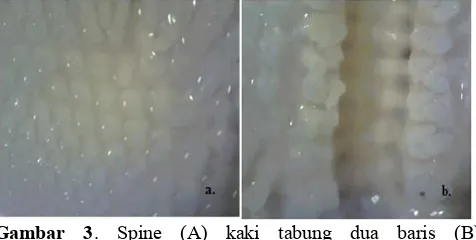 Gambar  3.  Spine  (A)  kaki  tabung  dua  baris  (B)