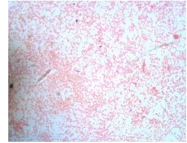 Gambar 17  Enterobacter sp., pewarnaan Gram, perbesaran objektif 100x 