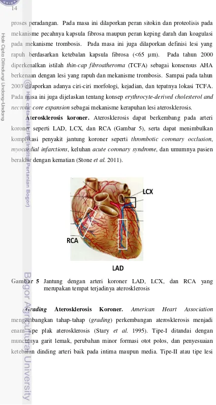 Gambar  5   Jantung dengan arteri koroner LAD, LCX, dan RCA yang 