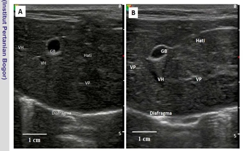 Gambar 4 Sonogram organ hati dengan arah transduser transversal. (A) Sonogram 