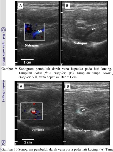 Gambar 9 Sonogram pembuluh darah vena hepatika pada hati kucing. (A) 