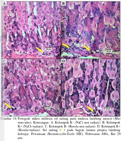 Gambar 16 Fotografi mikro infiltrasi sel radang pada mukosa lambung mencit ( Mus 