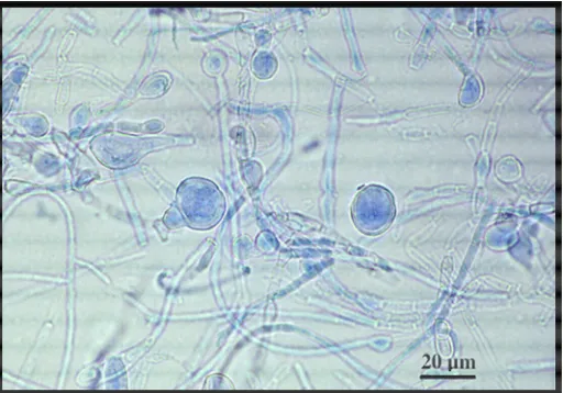 Gambar 4. Klamidospora pada Epidemophyton floccosum (sumber: 