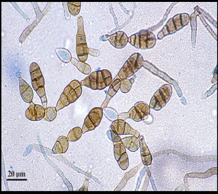 Gambar 7. Konidia pada Aspergillus nidulans (sumber: image.google.com) 