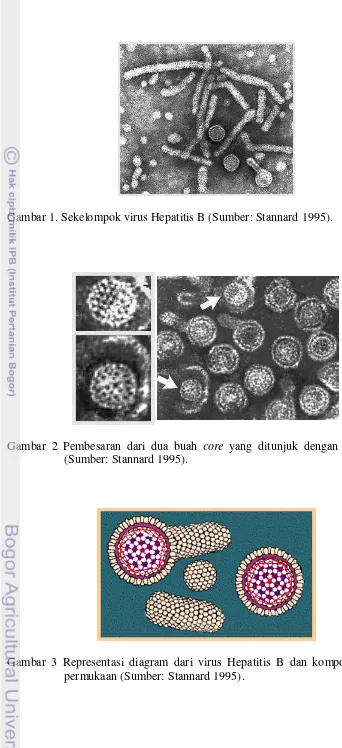Gambar 1. Sekelompok virus Hepatitis B (Sumber: Stannard 1995). 