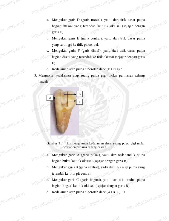 Gambar 3.7: Titik pengukuran kedalaman dasar ruang pulpa gigi molar permanen pertama rahang bawah Mengukur garis A (garis bukal), yaitu dari titik tanduk pulpa bagian bukal ke titik oklusal (sejajar dengan garis B)