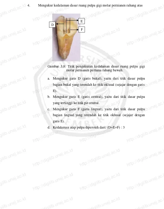 Gambar 3.8: Titik pengukuran kedalaman dasar ruang pulpa gigi molar permanen pertama rahang bawah