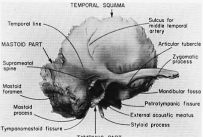 Gambar 1. Tulang temporal kanan, dilihat dari sisi lateral.  ( dikutip dari Ballanger’s )11  