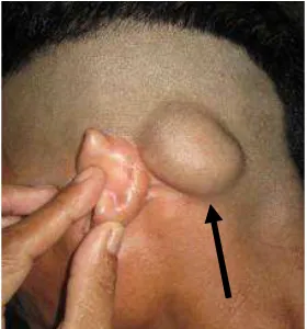 Gambar 3. Sebelum operasi  
