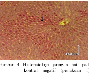 Gambar 4 Histopatologi jaringan hati pada kontrol negatif (perlakuan 1), kongsti (1), TAKS, pewarnaan HE, perbesaran 20x 