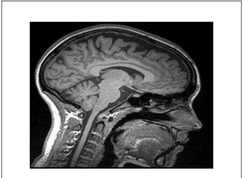 Gambar 1. Hasil citra medis MRI 