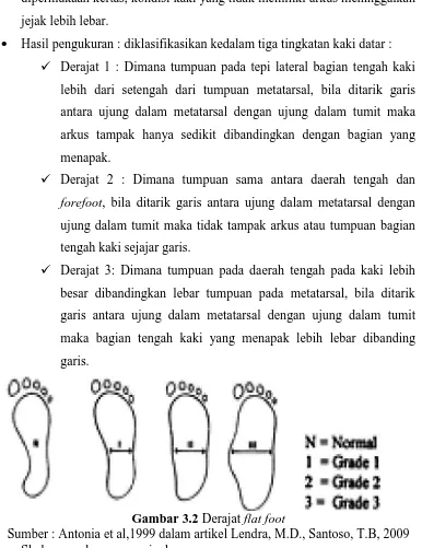 Gambar 3.2 Derajat flat foot Sumber : Antonia et al,1999 dalam artikel Lendra, M.D., Santoso, T.B, 2009 