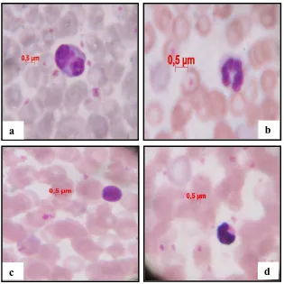 Gambar 4.4. Diferensiasi Leukosit Mencit (Mus musculus L.) Jantan yang diberikan ekstrak rimpang kapulaga (Amomum compactum) perbesaran 1000x dengan pewarnaan giemsa