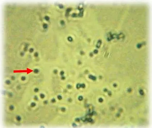 Gambar 3. Hasil uji bakteri Escherichia coli dengan menggunakan pe-warnaan Gram.  