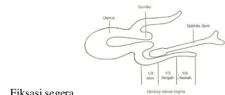 Gambar 1. Cara Mengambil Sekret Dinding Lateral Vagina  