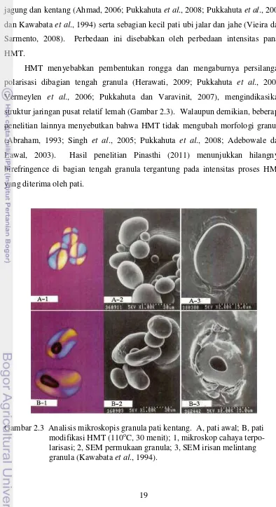 Gambar 2.3  Analisis mikroskopis granula pati kentang.  A, pati awal; B, pati o
