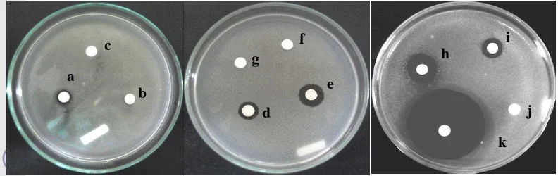 Gambar 1  Aktivitas antimikrob ekstrak etil asetat dari bakteri asal spons Jaspis sp. terhadap S