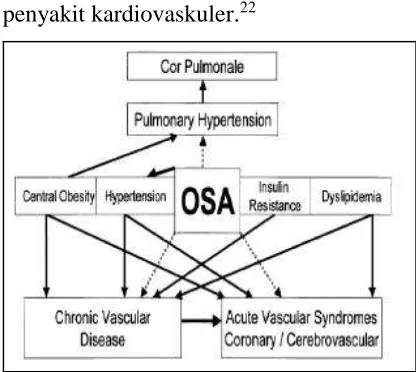 Gambar 2. Ilustrasi skema hubungan OSA  dengan penyakit Kardiovaskular.21 