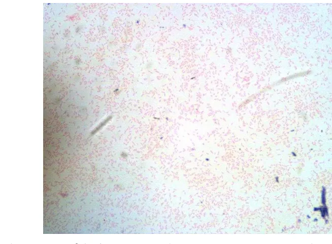 Gambar  20  Morfologi Proteus sp. dengan pewarnaan Gram, perbesaran objektif 