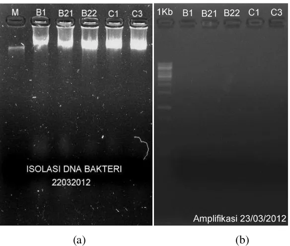 Gambar 4.  (a) Hasil elektroforesis isolasi DNA Escherichia coli, M = lamda  
