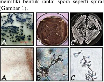 Gambar 1 Morfologi koloni aktinomiset endofit  umur 12  hari pada media YSA (atas) dan morfologi rantai spora yang diamati pada mikroskop cahaya perbesaran 400x (bawah); (A) CX 10.1 asal tanaman temulawak , (B) AJB 4(1) asal tanaman jati belanda, dan (C) A
