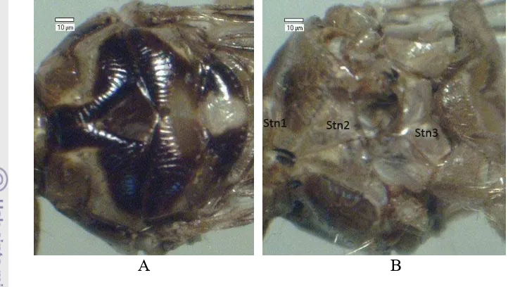 Gambar 8 Toraks H. equina pandangan dorsal (A), ventral (B). prosternum 