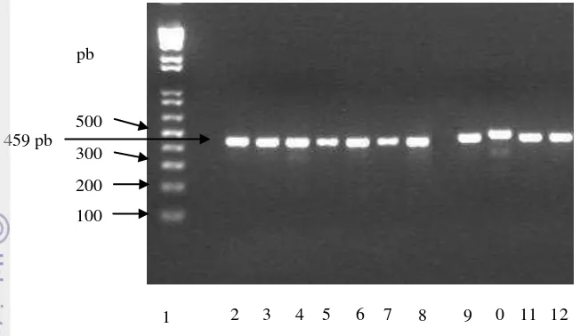 Gambar 5  Visualisasi PCR VHB Regio Pre-S1 yang menginfeksi spesies  