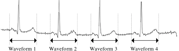 Fig. 1. Segmentation of the ECG Signal.   