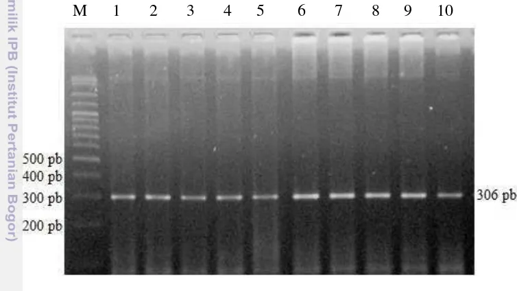 Gambar 4. Visualisasi Amplifikasi PCR Fragmen Gen FSHR Menggunakan Gel 