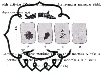 Gambar 2.3  Perubahan morfologik nukleus pada nekrosis. A. nukeus 