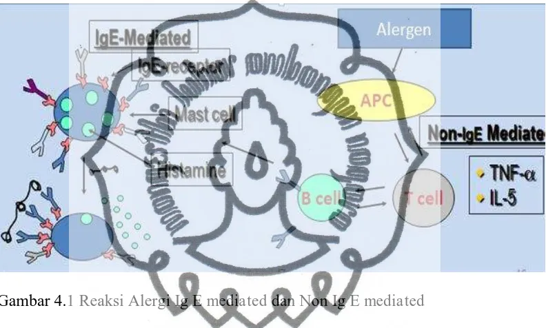 Gambar 4.1 Reaksi Alergi Ig E mediated dan Non Ig E mediated 