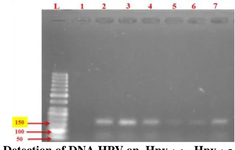 Fig 2: Detection of DNA HPV on  Hpv.JL: DNA Ladder, 1: Hpv..13 - Hpv.J.22 Samples J.13, 2: Hpv.J.14,3: Hpv.J.15  4 : Hpv.J.16, 5 : Hpv.J.17 , 6: Hpv.J.18, 7: Hpv.J.19, 8: Hpv.J.20, 9: Hpv.J.21, 10: Hpv.J.22  