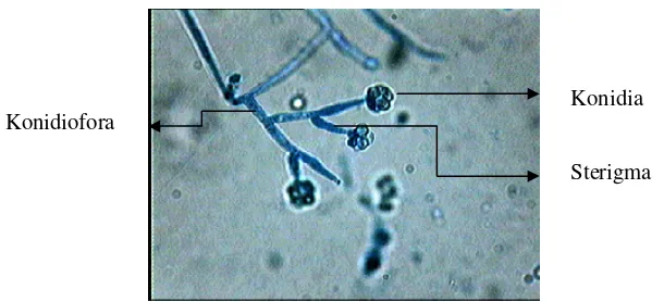 Gambar 7. Trichoderma sp. (www2.Ac-lycon.com) 