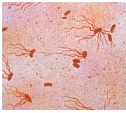 Gambar 1. Salmonella Typhimurium 
