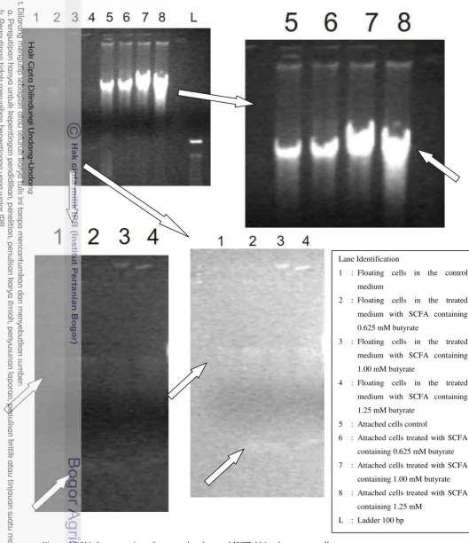 Figure 4 DNA fragmentation of untreated and treated HCT-116 colon cancer cells 