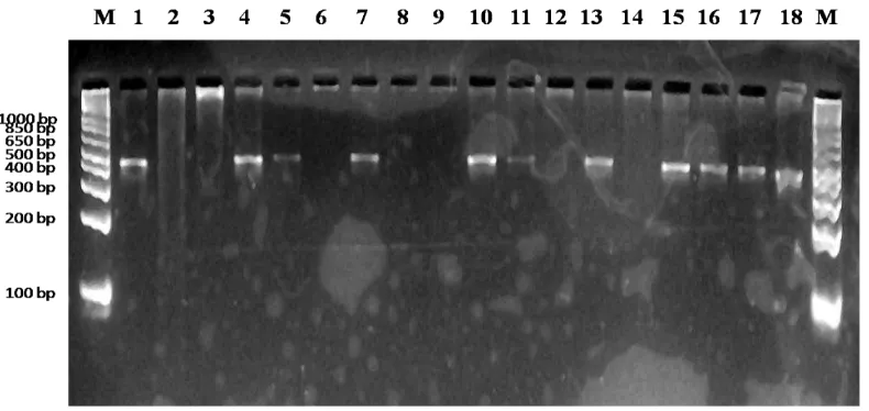 Gambar 6. Amplifikasi 18 DNA kelapa sawit Lame silang lanjut tipe pisifera  