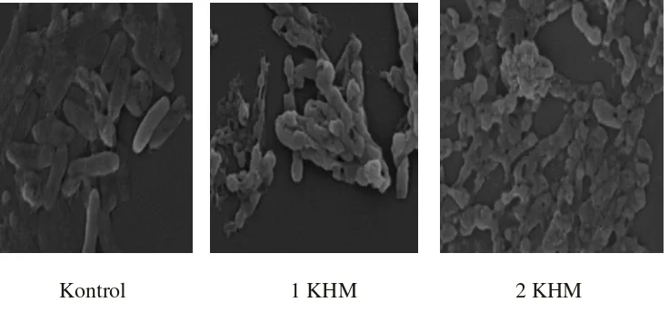 Gambar 7. Fotograf SEM sel  S. flexneri yang diperlakukan dengan (+)- katekin. 