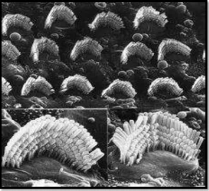 Gambar 2. 3. Kerusakan sel-sel rambut luar yang luas dan   minimal pada sel-sel rambut dalam (Maltby 2005) 
