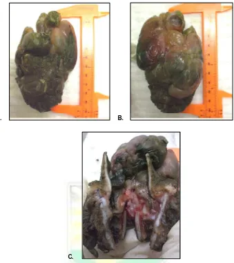 Gambar 2. Massa tumor laring (supraglotis dan glotis) dengan konsistensi kenyal padat, berwarna kemerahan, berlobus-lobus dengan permukaan licin, ukuran 10x6x3 cm, (A) tampak depan, (B) tampak belakang, (C) potongan endolaring