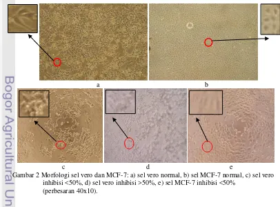 Gambar 2 Morfologi sel vero dan MCF-7: a) sel vero normal, b) sel MCF-7 normal, c) sel vero 