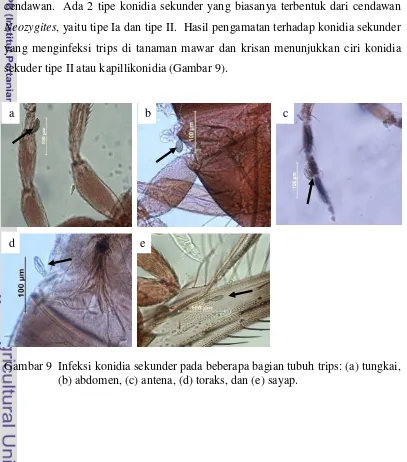 Gambar 8  Hyphal bodies berbentuk batang pada abdomen trips 