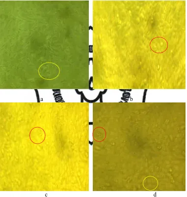 Figure 1. The result of the appearance of MCF-7 cells in cytotoxicity tests on the                    Description:         ; living cells magnification of 80 × after the addition of combination extract of Pandanus conoideus Lam.var Yellow and Red Fruit in 