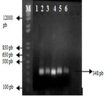 Gambar 3 Elektroforegram kualitas DNA 