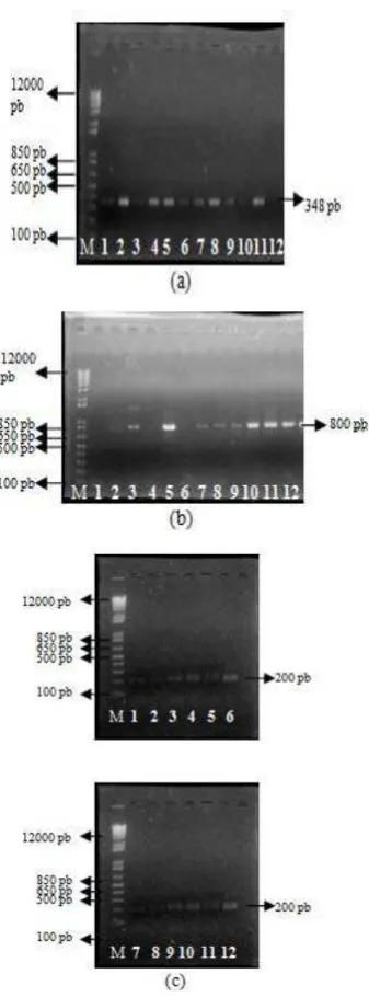 Gambar 5 Elektroforegram hasil optimasi 