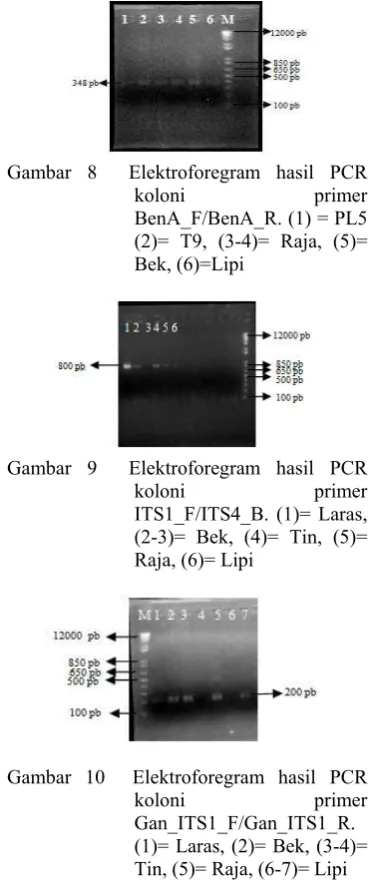 Gambar 10  Elektroforegram hasil PCR 
