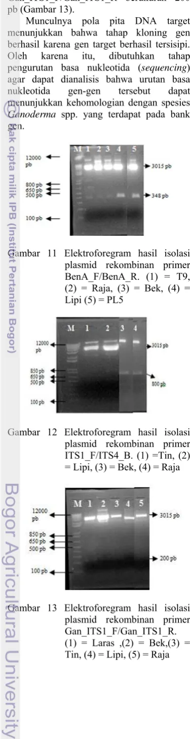 Gambar 11 Elektroforegram hasil isolasi 