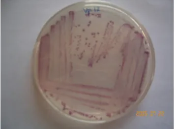 Gambar 1: Isolat Vibrio parahaemolyticus hasilisolasi pada media CHROMAgar Vibrio