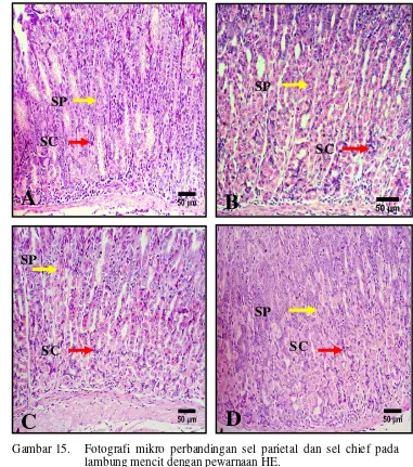 Gambar 15. Fotografi mikro perbandingan sel parietal dan sel chief pada 